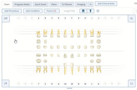Changing Dentition In The Tooth Chart Dentrix Ascend