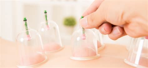 the amazing benefits of cupping treatment acupuncture continuing education acupuncture