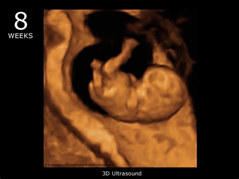 9 Weeks Pregnant 3d Ultrasound
