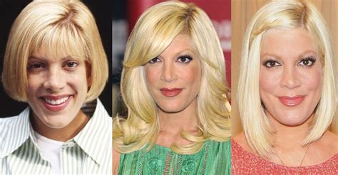 Tori Spelling Plastic Surgery Before And After Pictures