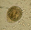 Balantidium coli - DocCheck