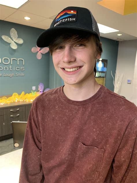 Getting My Braces Off And Finally Being Confident To Smile Rpics