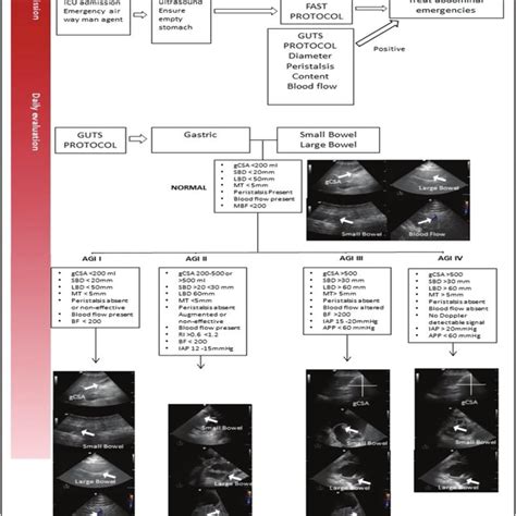 Gastrointestinal And Urinary Tract Sonography Protocol Data From 40