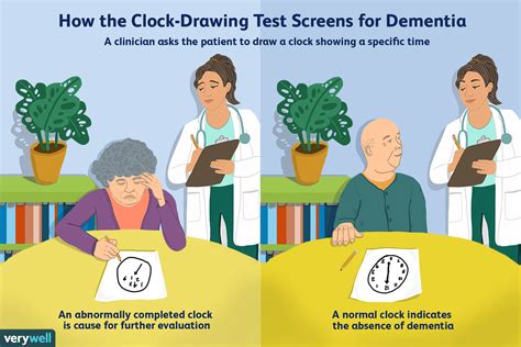 • please draw a line, going from a number to a letter in ascending order. How the Clock-Drawing Test Screens for Dementia