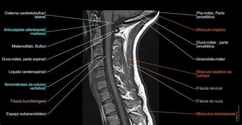 Coluna Cervical Irm Anatomia Normal E Anatomy