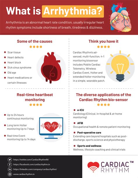 Infographic On What Is Arrhythmia Cardiac Rhythm