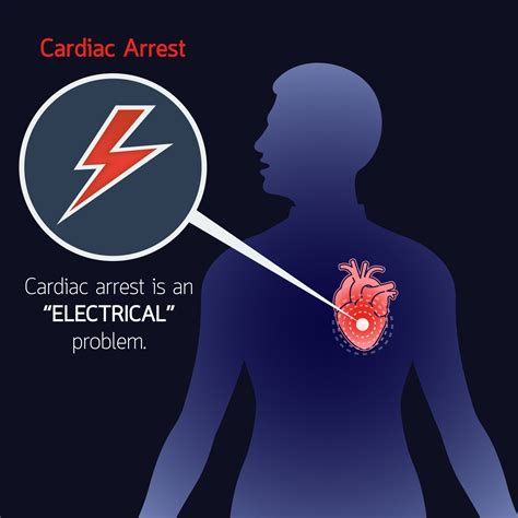All You Should Know About Cardiac Arrest Apollo Hospitals Blog