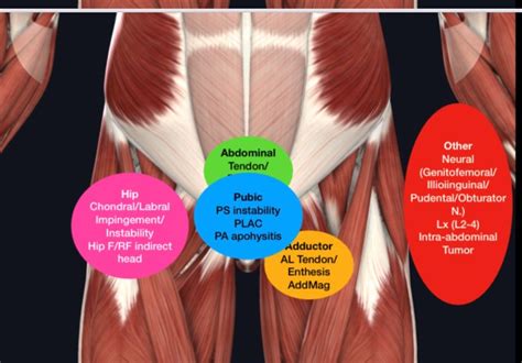 About Groin Pain Complete Balance Physiotherapy