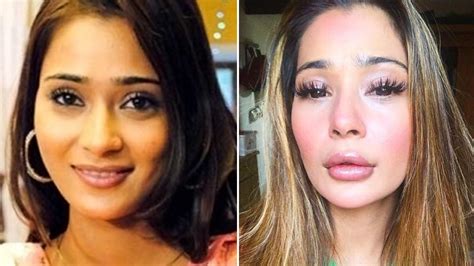 Sara Khan Trolled For Plastic Surgery ‘gone Wrong Actor Says She