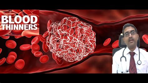 Precautions While Taking Blood Thinners Anticoagulants Youtube