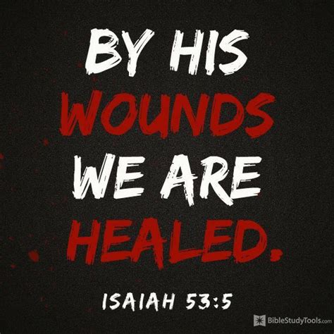 You Are Healed In Jesus Name In 2020 Healing Quotes Healing Heart