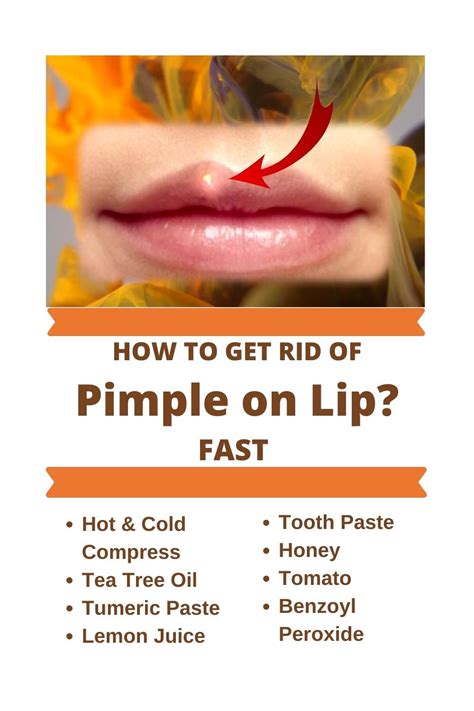 How To Get Rid Of Pimple On Lip Line Overnight Jun 05 2020 · Some