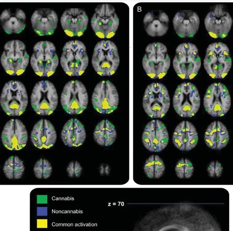 Cannabis And The Brain The Good The Bad And The Unknown Mybraintest