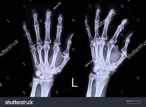 This is simply because a laptop offers them a larger screen with an enhanced experience. Edit Vectors Free Online - X-ray left | Shutterstock Editor