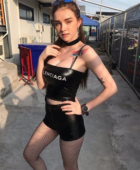 Jessie Vard Irish Model Sparks Surgery Fears With Instagram Video