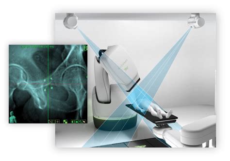 Prostate Sbrt With Cyberknife Precise Innovative Tumor Treatments Accuray