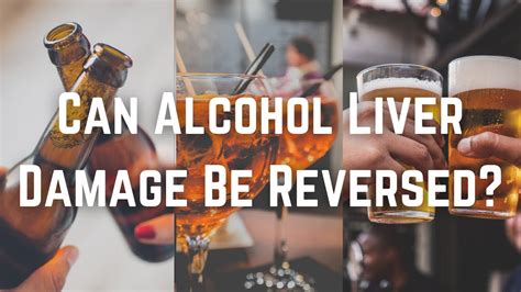 Can Alcohol Liver Damage Be Reversed Youtube