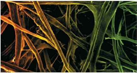 The plant cell wall is mainly composed of cellulose. What kind of bonds are present in Cellulose - Biology ...
