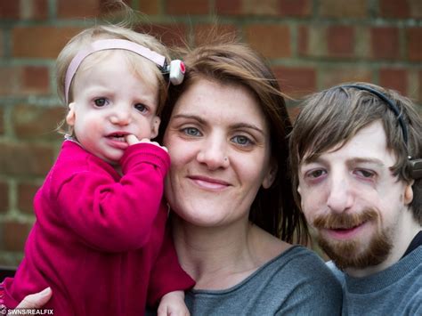 Accused Of Being Cruel Parents Couple Defend Their Decision To Have A Baby With Facial