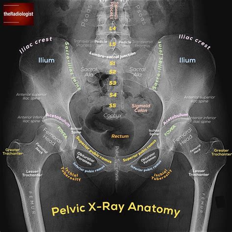 Please Tag If You Wish To Share ——— Theradiologist Radiology