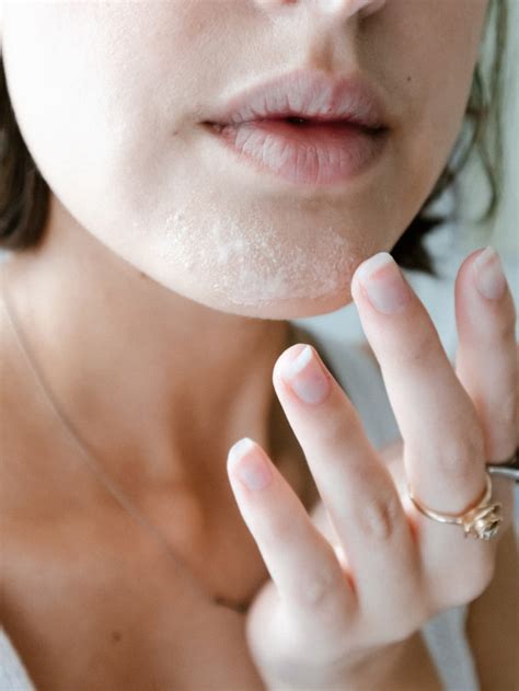 The Best Spot Treatments To Zap Zits The Chriselle Factor