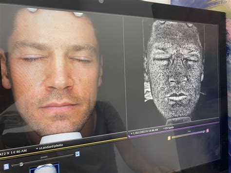 Oneskin Os 1 Does It Work The Science Says Yes —