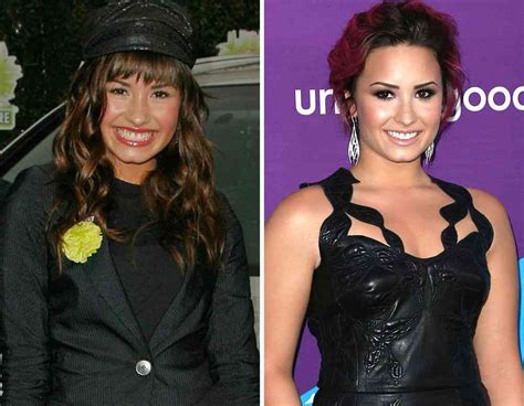 Demi Lovato Then And Now Viral Gala