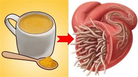 Natural Ways To Get Rid Of Intestinal Worms In No Time Youtube