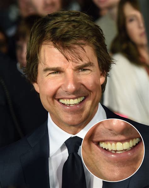 Tom Cruises Middle Tooth — The Story Behind His Smile