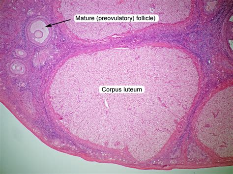 Loose Body Histology