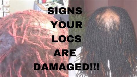Signs That Your Dreadlockslocs Are Damagedi Essenceofshay Youtube