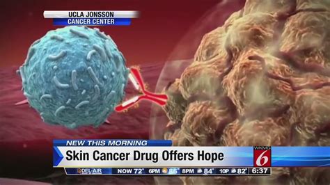Skin Cancer Drug Offers Hope