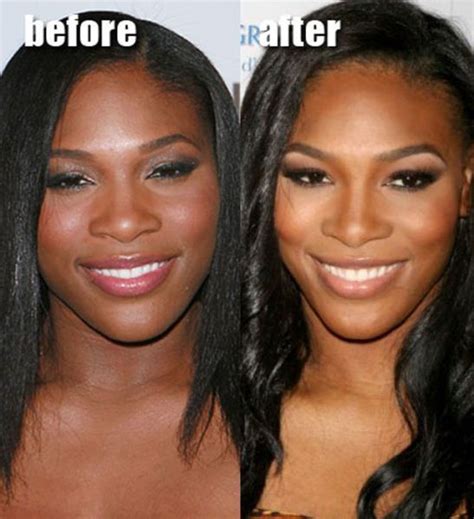 Serena williams is many things: Celebrity Plastic Surgery Before & After (56 pics) | Celebrity plastic surgery, Cosmetic surgery ...