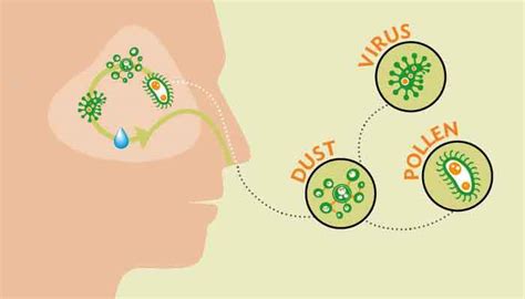 How To Remove Sinus Mucus Plug At Home A Complete Guide