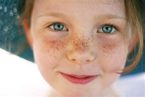 Baby Freckles On Face Yung Clary