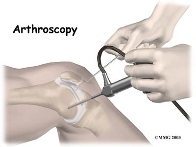 From the mushroom kingdom to the bowels of hell, this podcast will take you on an epic quest to deflower the princess! Knee Arthroscopy | eOrthopod.com