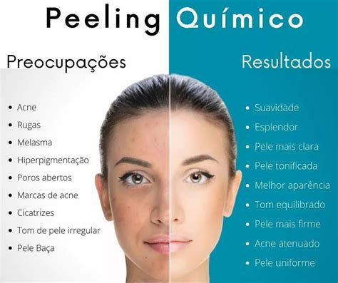 Peeling Químico Peeling Químico Estética Facial Biomedicina Estética