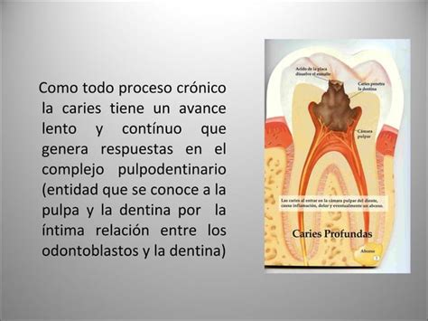 Patología Pulpar Y Periapical 2 Ppt