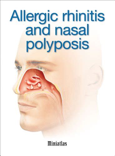 Allergic Rhinitis And Nasal Polyposis Miniatlas Ebook Lepori Luis