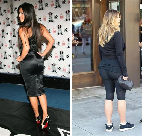 Kim Kardashian Butt Implants Plastic Surgery Before And After Photos 2018 Plastic Surgery