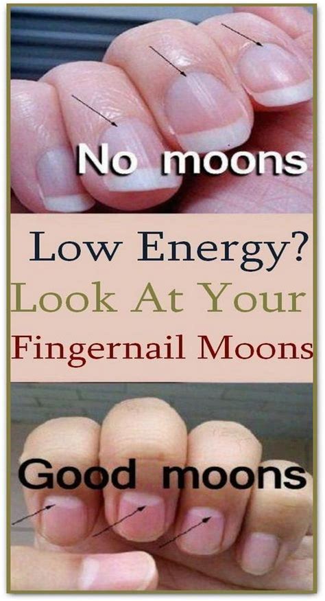 Do You Know What The Half Moon Shape On Your Nails Means The Answer