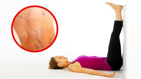 Practice These Poses To Prevent Varicose Veins And Other Legs Troubles