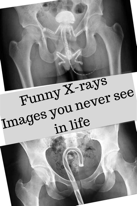 Funny X Rays Images Book Jokes Funny Pictures Laugh Out Loud