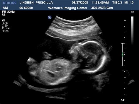 Its A Boy Ultrasound 20 Weeks Due Date Jan 16th Priscilla Flickr