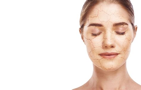 Dry Skin Causes Symptoms And Effective Remedies
