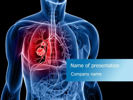 Lung Cancer Presentation Template For PowerPoint And Keynote PPT Star