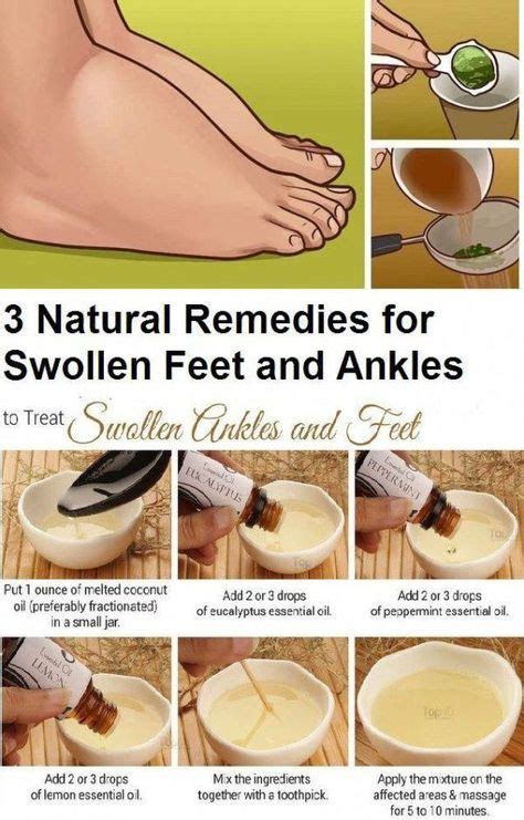 3 Natural Remedies For Swollen Ankles And Feet Fitness And Fitness