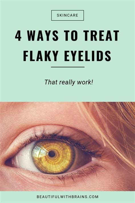 4 Ways To Treat Flaky Eyelids Beautiful With Brains