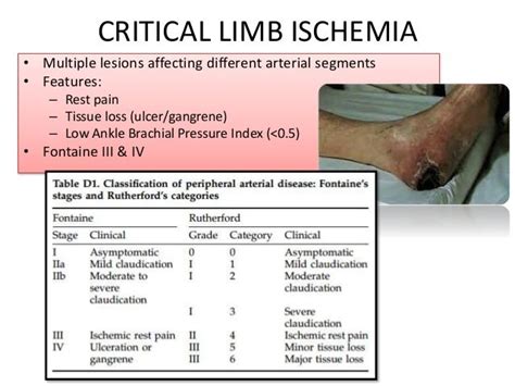 Chronic Limb Ischemia