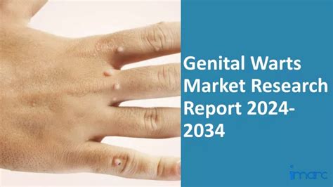 Ppt Genital Warts Market 2024 2034 Powerpoint Presentation Free Download Id 12895896